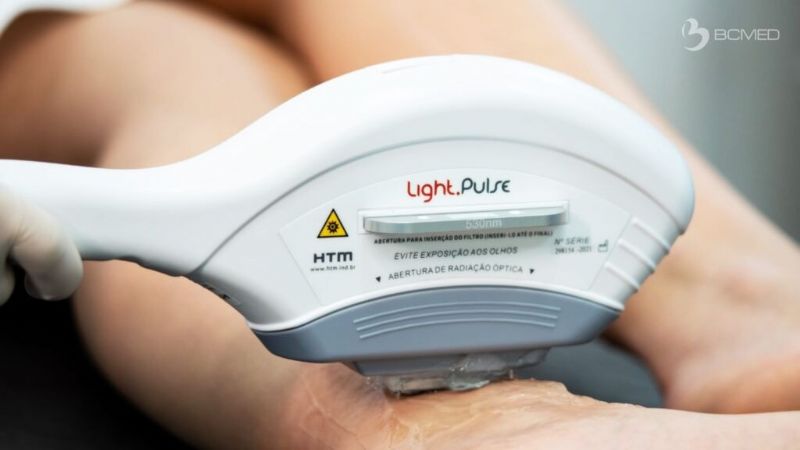 Depilação Definitiva